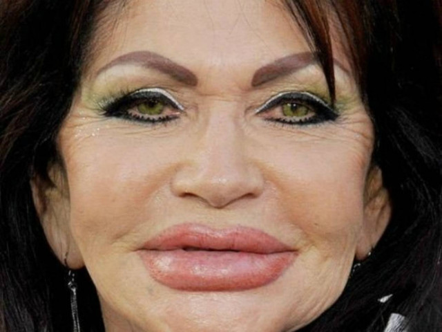 Πλαστικές επεμβάσεις... σκέτη αποτυχία (pics)