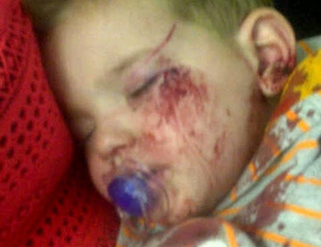 Σοκ: Γεράκι κατασπάραξε ένα δίχρονο παιδάκι!