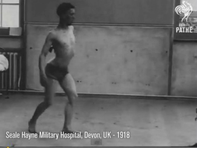 Στρατιώτες θεραπεύονται από το σοκ του Ά Παγκoσμίου πολέμου (vid)