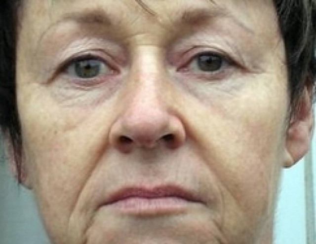 Ξόδεψε 6.000 ευρώ σε πλαστικές επειδή έμοιαζε σαν μάνα του φίλου της