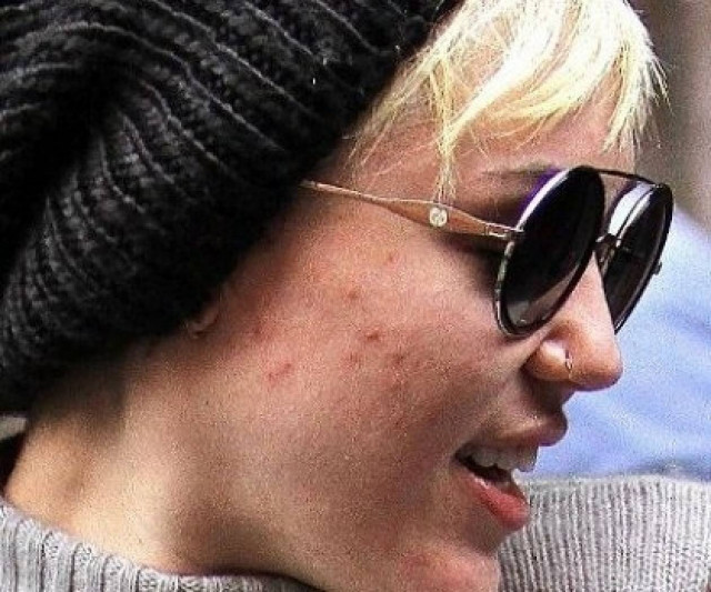 Η Miley Cyrus δεν είναι τόσο τέλεια όσο πιστεύαμε!