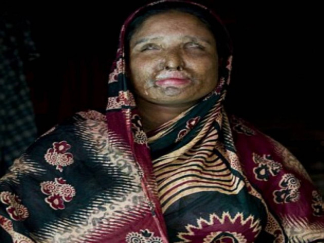 Την αναγκάζουν να ξαναπαντρευτεί αυτόν που της έριξε οξύ στο πρόσωπο