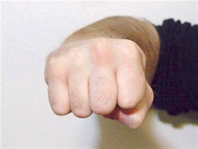 Μάνα και κόρη ξυλοκόπησαν δημοτικό σύμβουλο