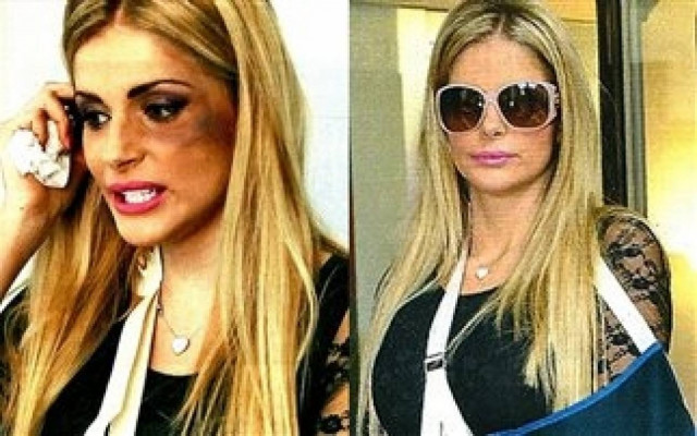 Ιταλίδα ηθοποιός έπεσε θύμα ξυλοδαρμού! (pics)