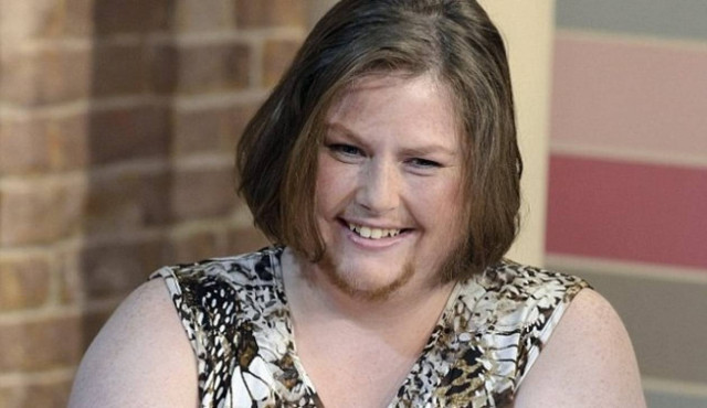 Η γυναίκα που αφήνει να της φυτρώσει μούσι επειδή...