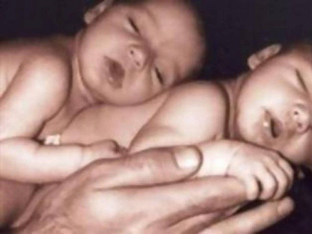 Γέννηση διδύμων από γυναίκα με μεταμόσχευση ήπατος