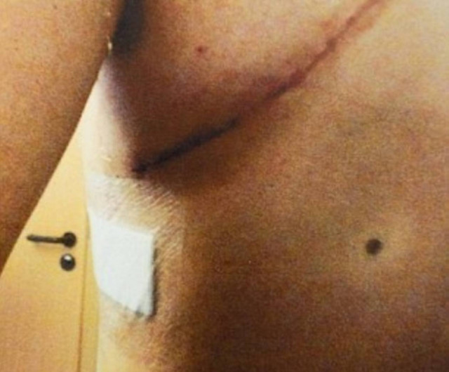 Απίστευτο: Δείτε γιατί κινδύνευσε να εκραγεί η καρδιά του