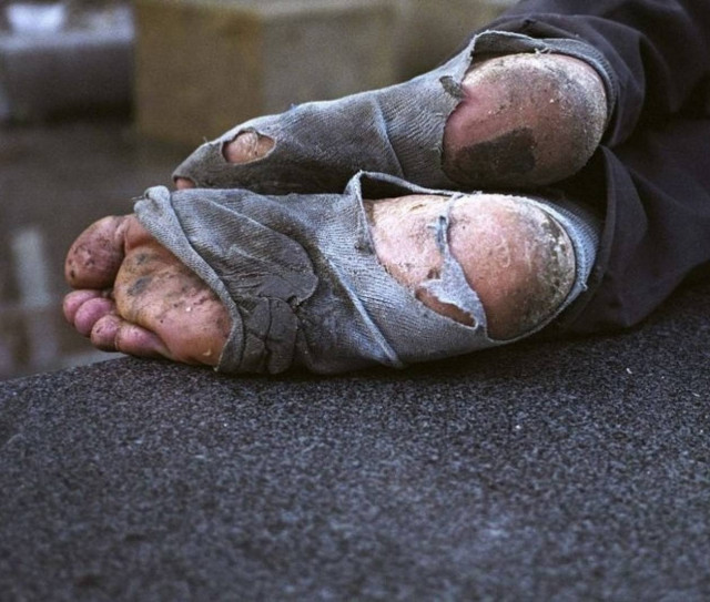 Άστεγος πήρε φωτιά από την λάμπα του