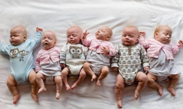 Ιταλίδα γέννησε εξάδυμα που συνέλαβε φυσιολογικά!