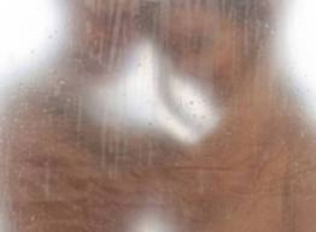 61χρονη έπαθε αμνησία λόγω... σεξ