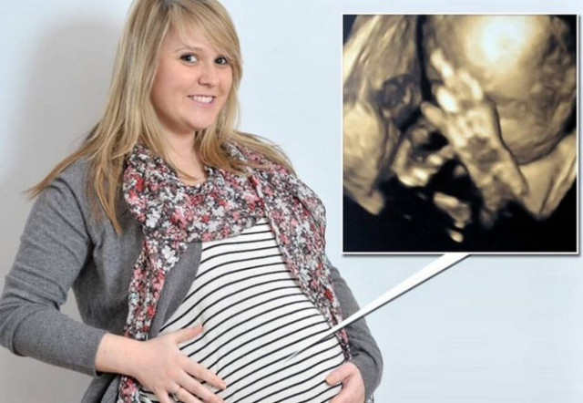 Αγέννητο μωρό κάνει άσεμνη χειρονομία μέσα από την κοιλιά της μητέρας