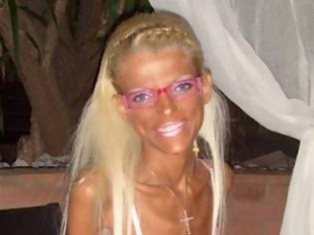 Νανά Καραγιάννη: Επιτέλους πήρε κιλά, δείτε το πρόσωπο της