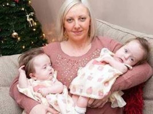 Τα κόκκαλά τους σπάνε με το παραμικρό