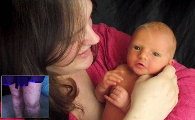 Απίστευτο: Η μητέρα που είναι αλλεργική στο παιδί της