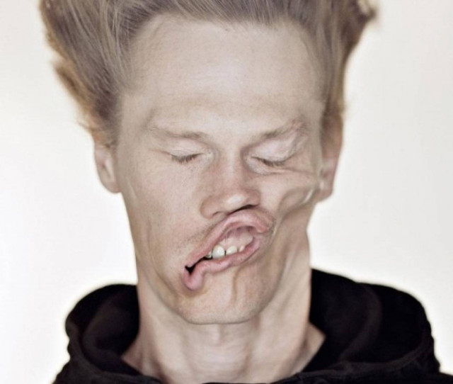 Δείτε από τι παραμορφώθηκε το πρόσωπό τους! (pics)