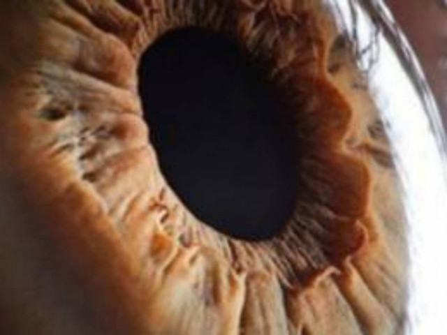 Μπορείτε να καταλάβετε τι είναι αυτό;