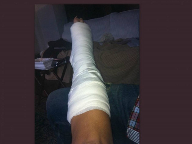 Με σπασμένο πόδι η Φαίη σήμερα στο Πρωινό mou