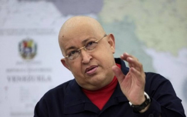 Πολύ ανησυχητική η κατάσταση της υγείας του Ούγκο Τσάβες