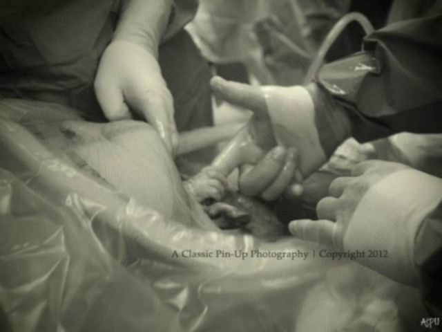 Εκπληκτική φωτογραφία:«Χειραψία» βρέφους με γιατρό την ώρα της γέννας