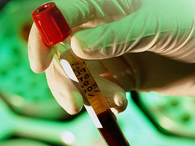 Θεσσαλονίκη: Αποζημίωση 800.000 ευρώ σε 25χρονη που μολύνθηκε με AIDS