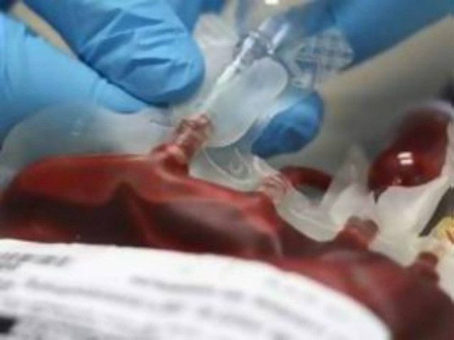 ΕΠΕΙΓΟΝ: Έκκληση για αίμα για ένα εξάχρονο παιδί