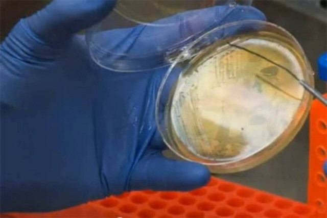 Συναγερμός στην Κούβα με νέα επιδημία