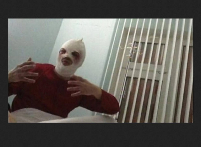 Απειλές δεχόταν ο καλλιτεχνικός διευθυντής των μπαλέτων Μπολσόι