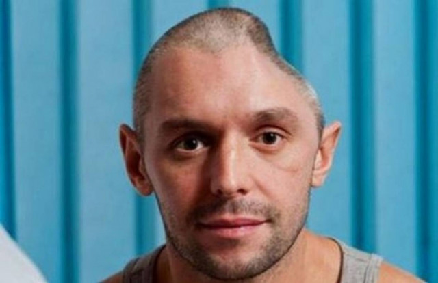 Aπίστευτο: Επέζησε αν και έχασε σχεδόν το μισό κρανίο του