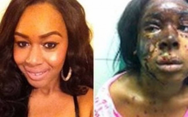 ΣΟΚ: Πέταξε οξύ στο πρόσωπο εργαζόμενης στα Victoria΄s Secret