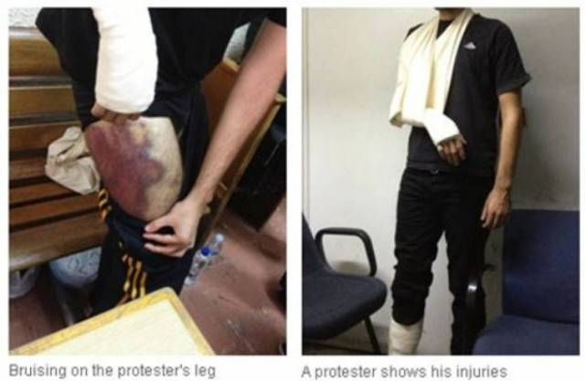 Ερώτηση ΣΥΡΙΖΑ για τις αποκαλύψεις του Guardian περί βασανισμών