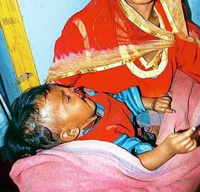 ΣΟΚ: Ο μεθυσμένος πατέρας της της... έφαγε τη μύτη και τα χείλη!