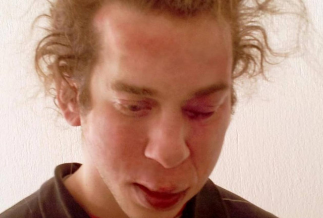 Η μητέρα του Μπουρζούκου καταγγέλλει τις συνθήκες μεταγωγής (pics)