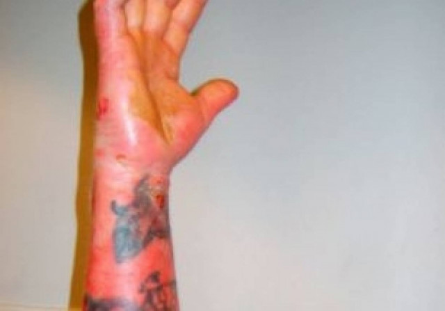 ΣΟΚ: Δείτε τι έπαθε όταν χτύπησε με σφυρί ένα καλώδιο 11,000 volt!