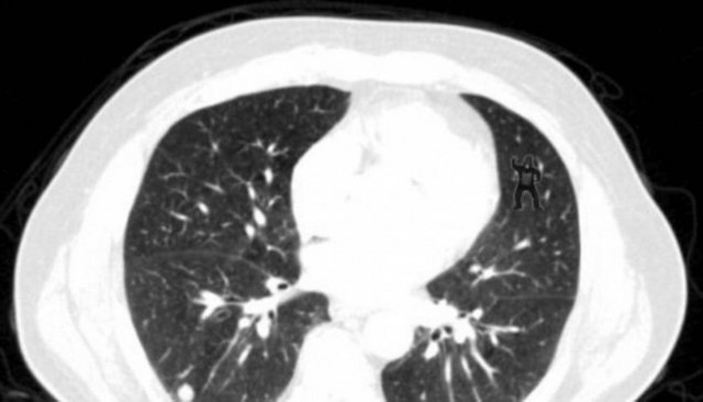 Τεστ: Δείτε την εικόνα - Πόσο παρατηρητικοί είσαστε;