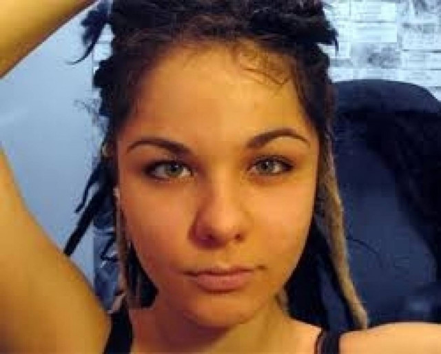 Δείτε πώς έγινε αυτό το όμορφο κορίτσι μετά από ενέσεις σιλικόνης