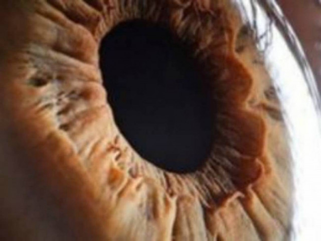 Μπορείτε να καταλάβετε τι είναι αυτό; (pics)