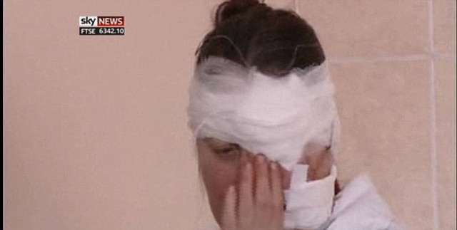 Απολογισμός: 82 παιδιά στους τραυματίες από την βροχή μετεωριτών