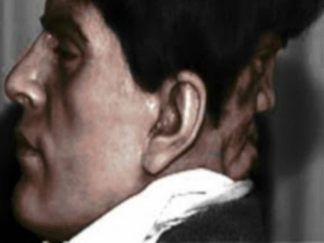 Απίστευτο: Ο άνθρωπος με τα δύο πρόσωπα!