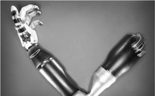 Βιονικό χέρι με αίσθηση αφής