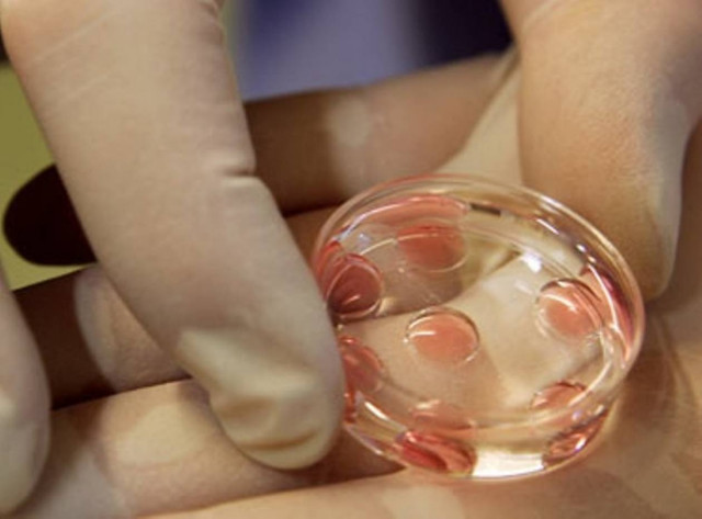 Εξαρθρώθηκε δίκτυο διακίνησης ωοκυττάρων