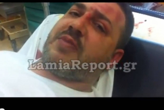 Βίντεο: Περιγράφει τη σκηνή του πυροβολισμού που δέχτηκε