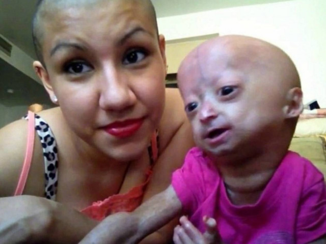 Βίντεο: Η εξάχρονη που ζει σε σώμα ηλικιωμένης