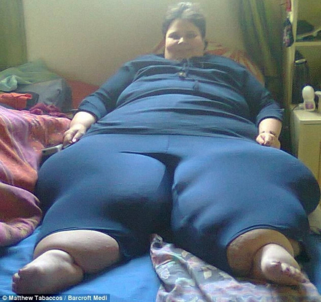 ΣΟΚ: Δείτε πως πρήστηκαν τα πόδια της από το τσίμπημα ενός κουνουπιού