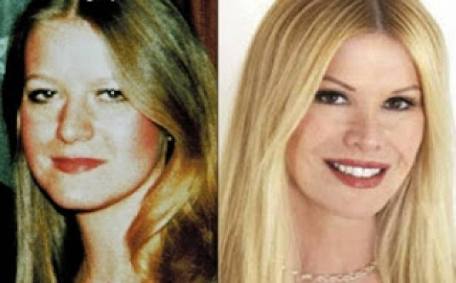 Έκανε 52 πλαστικές επεμβάσεις... Δείτε πώς έχει γίνει! (pics)