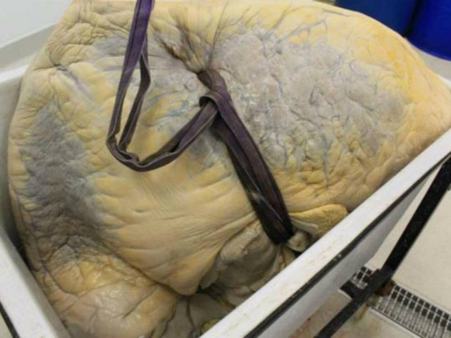 Μπορείτε να μαντέψετε τι είναι αυτό;