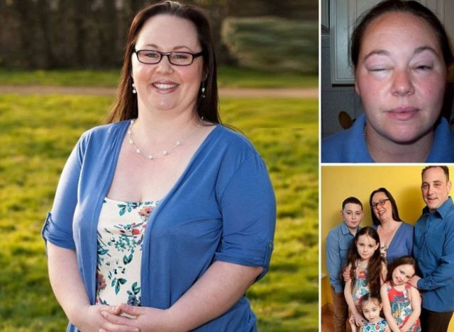 Η γυναίκα με την πιο περίεργη αλλεργία που έχετε ακούσει!