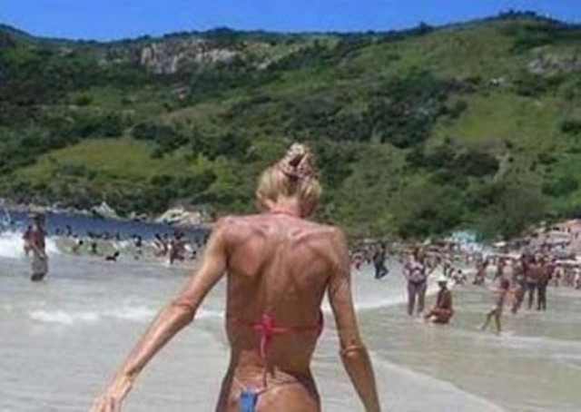 Σοκ: Η σιλικόνη δεν πεθαίνει ποτέ...(pics)