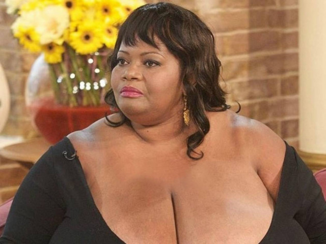 Κι όμως υπάρχει! Το στήθος αυτής της γυναίκας ζυγίζει... 100 κιλά!