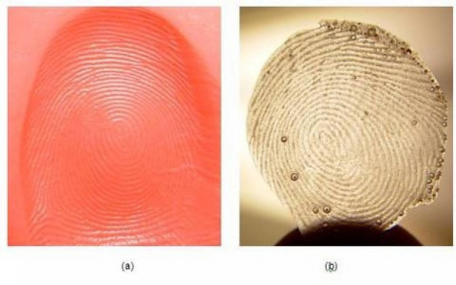 Απίστευτη κομπίνα: Δείτε πως γιατροί έκαναν... κοπάνα!