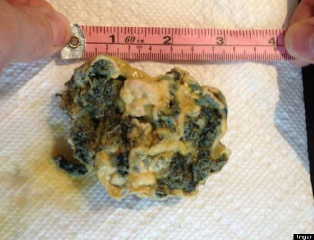 Έπαθε ΣΟΚ με αυτό που βρήκε μέσα στον χυμό που έπινε